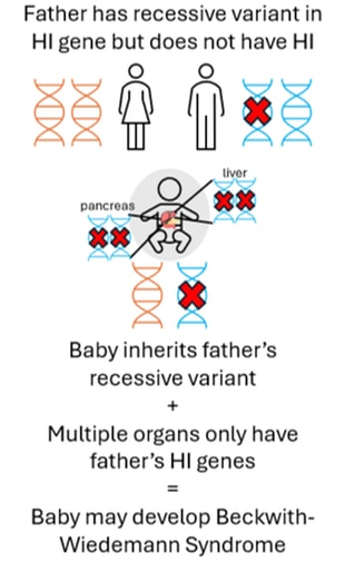 Beckwith-Wiedemann Syndrome