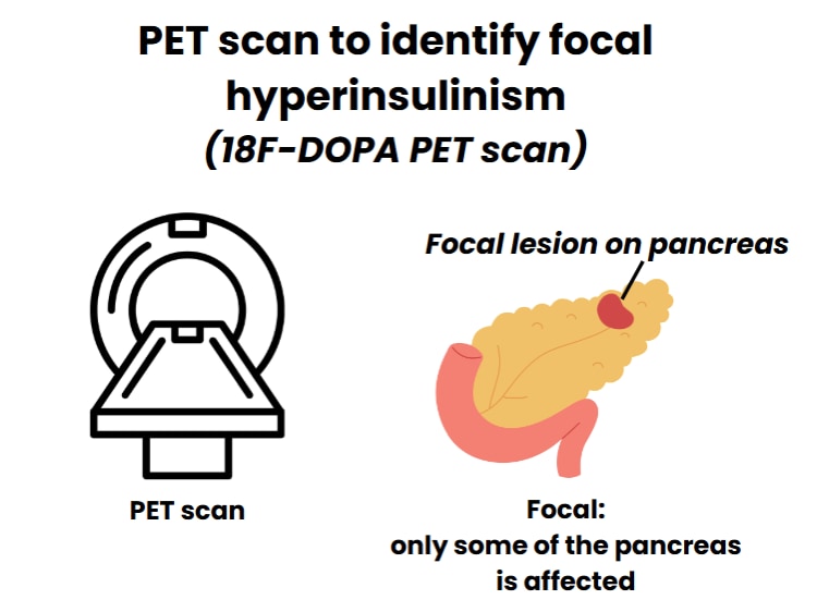 PET scan diagram