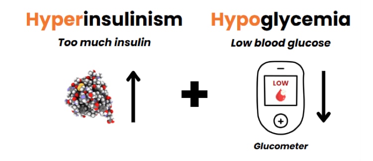 hyperinsulinism vs hypoglycemia