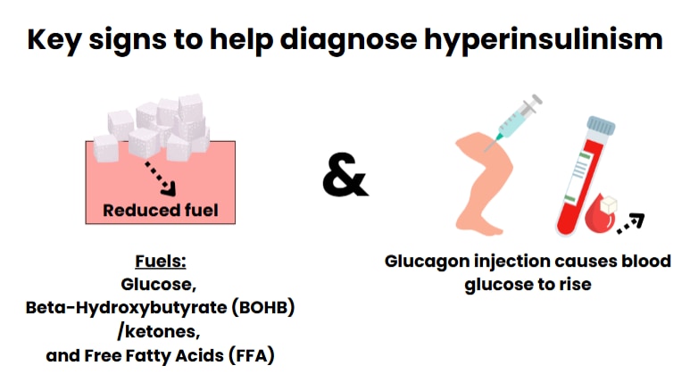 key signs to help diagnose hyperinsulinism