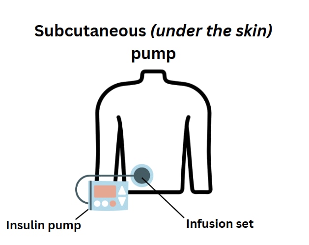 Under the Skin Pump, image 2